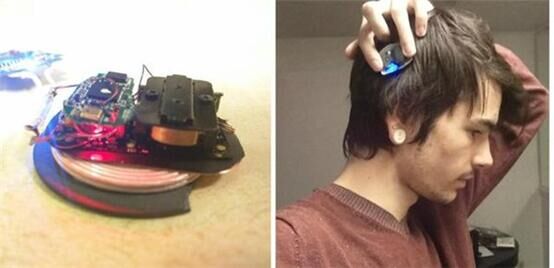 Implanting a phone in the head